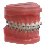 Брекеты Damon Clear2 из керамики