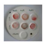 Определение группы крови цоликлонами по системе AB0